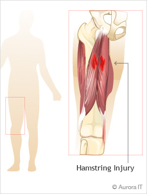 hamstring-injury